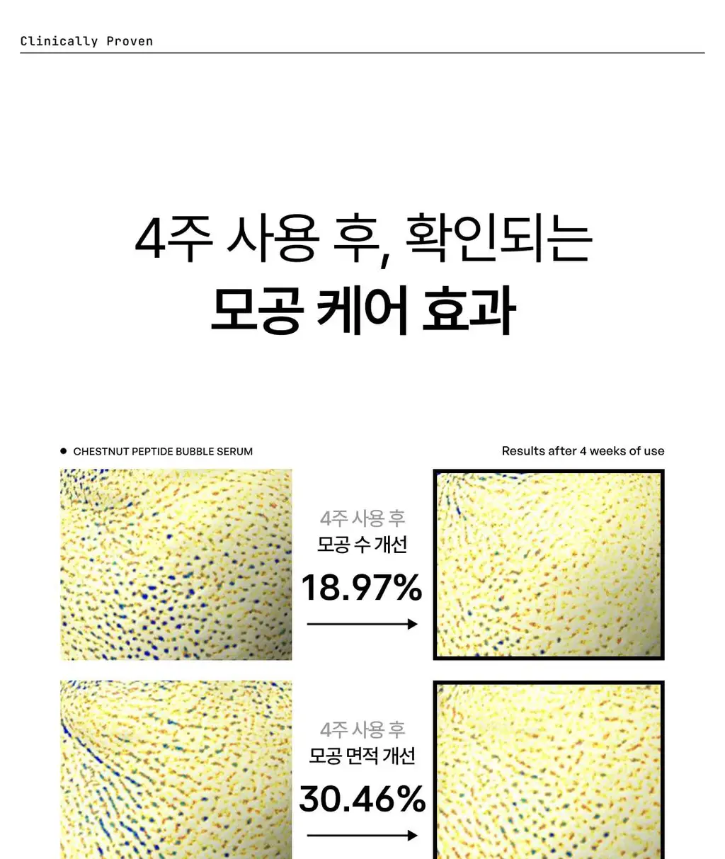 [NEW] 포들 밤 펩타이드 모공 타이트닝 버블 세럼 70ml 상세페이지 15